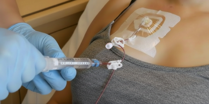 A healthcare worker with blue gloves is administering medication through a syringe into an IV port connected to a patient's chest. The patient is wearing a gray shirt, and an adhesive patch is placed near the IV site.