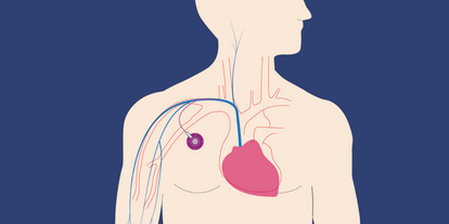 Illustration of a human torso highlighting the heart and major blood vessels. The heart is depicted in pink, with blue and red lines representing arteries and veins, illustrating the circulatory system. The background is a solid dark color.
