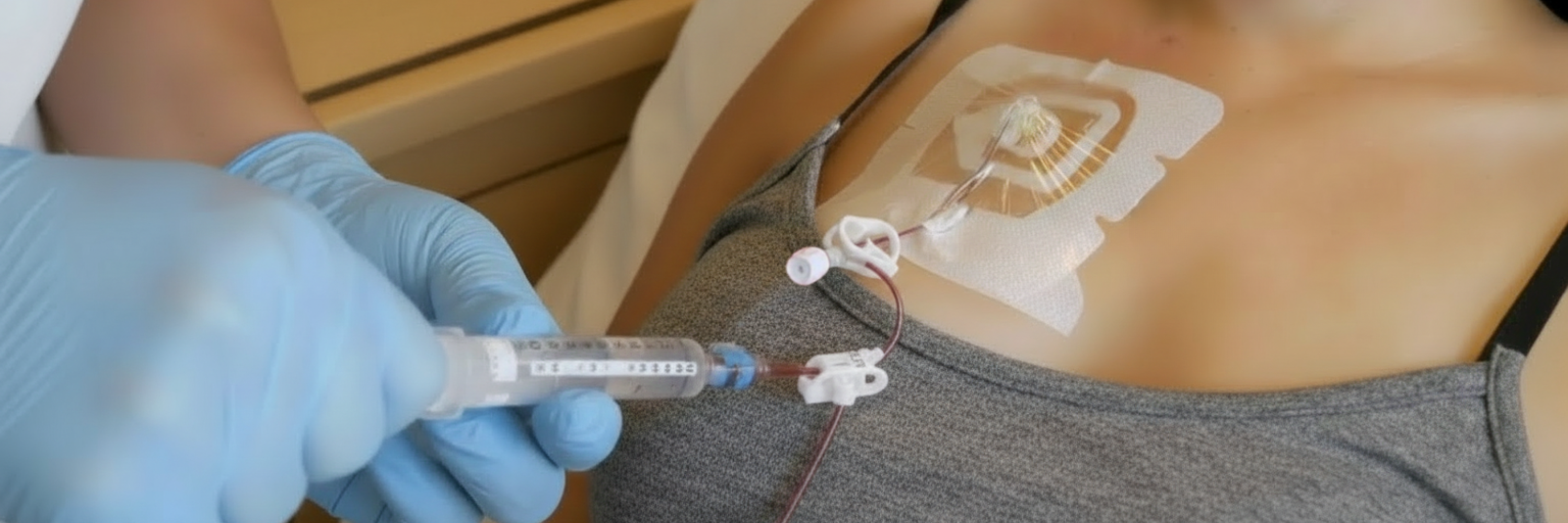 A close-up of a medical professional administering an injection via a syringe connected to an IV line on the chest of a patient. The patient's skin shows a medical patch and the IV entry point. The setting appears to be a healthcare environment.