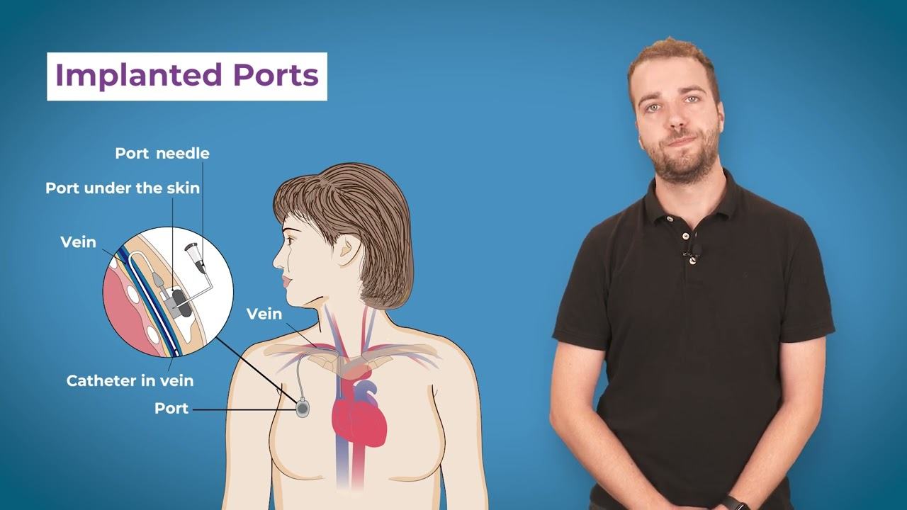 Vascular Access and Oncology