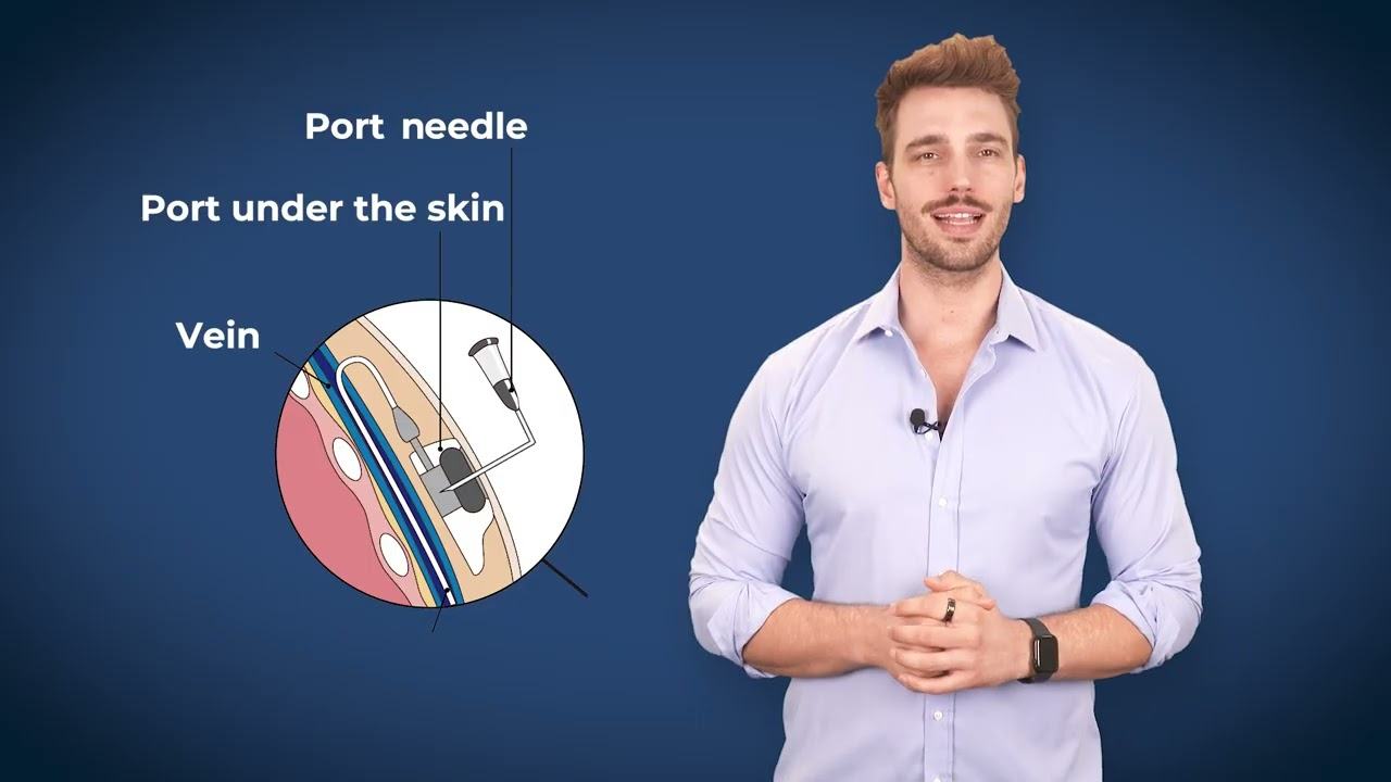 Port Systems Indication and Implantation
